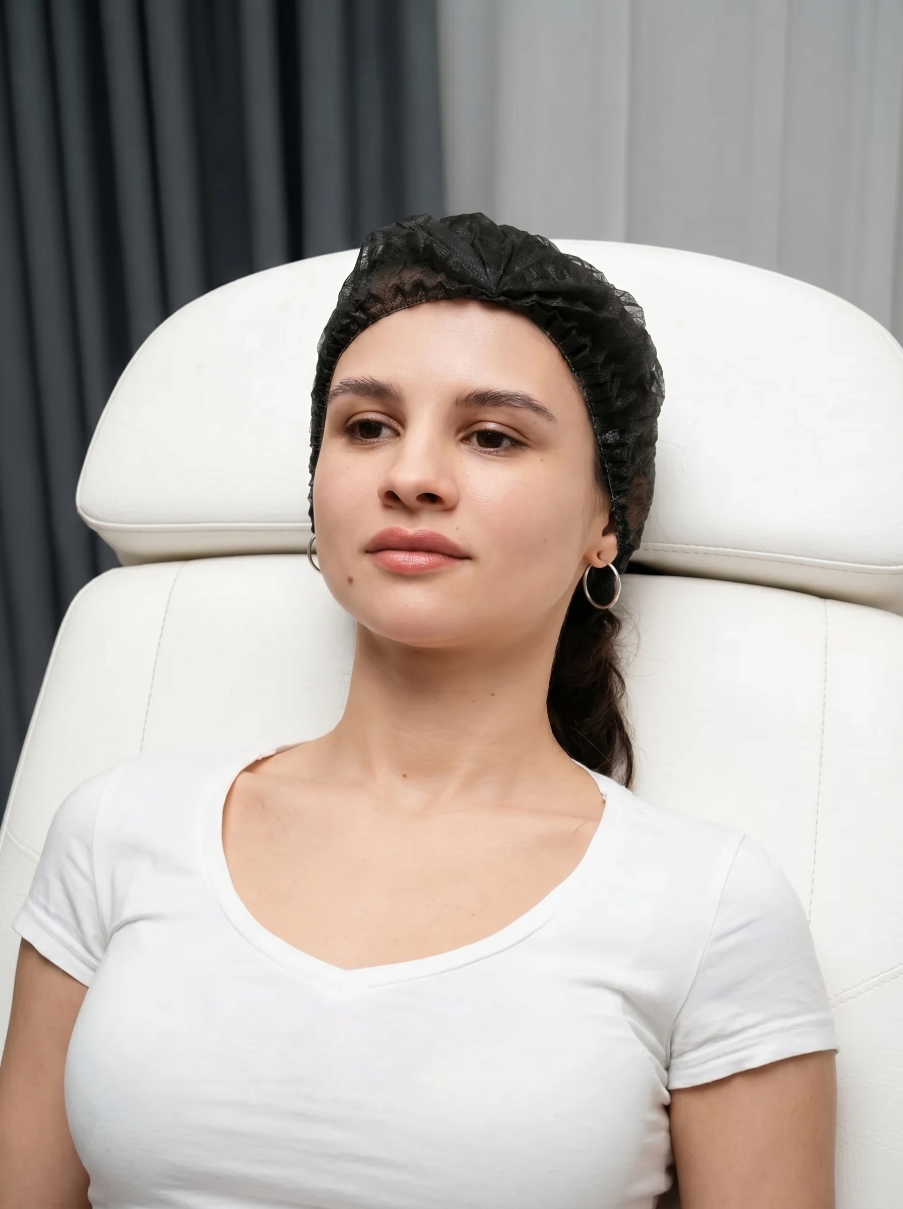 Cupid's bow lip filler benefits definition with sharper contour and natural lip enhancement.