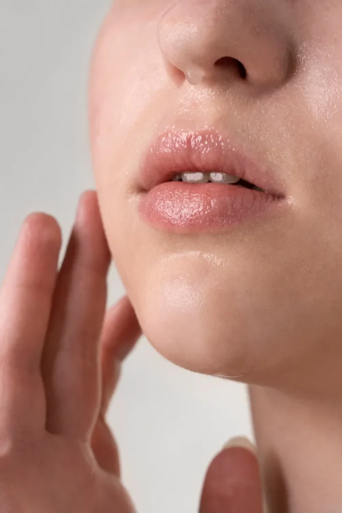 Targeted lip filler dissolving precision treatment removing specific areas for balanced lips.