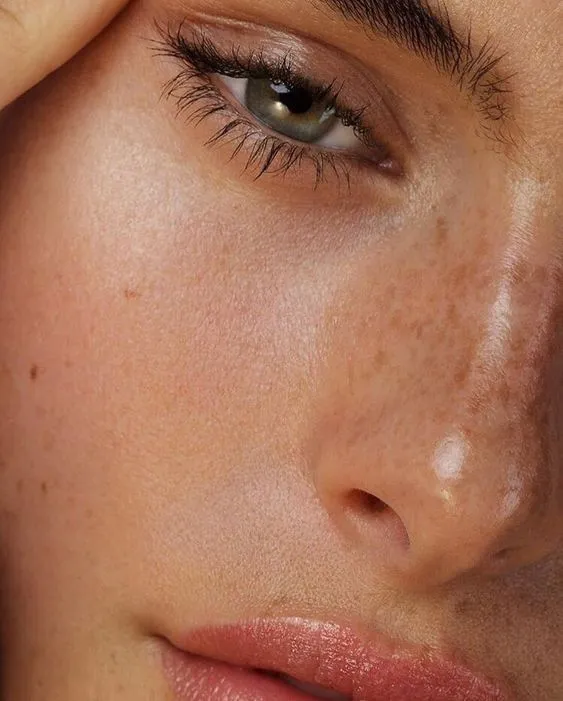 Volume loss beneath the eyes is one of the earliest and most visible signs of facial ageing. As the periorbital fat pads descend and dermal support diminishes, hollow tear troughs form — casting shadows that contribute to the appearance of dark circles and persistent fatigue. Teosyal Redensity 2 is a hyaluronic acid-based filler developed specifically for this delicate eye area. At our London clinic, tear trough filler treatment using professional Redensity 2 is planned individually, with technique and volume determined by anatomy, skin quality, and the degree of correction required.